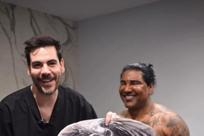**Omega El Fuerte se tatúa la espalda completa durante procedimiento con sedación en España** El merenguero urbano Omega El Fuerte viajó a España para realizarse un tatuaje de un arcángel en toda la espalda, en un procedimiento que llamó la atención por llevarse a cabo bajo sedación intravenosa. El trabajo fue realizado por el tatuador Miguel Bohigues, quien mostró parte del proceso en sus redes sociales y explicó que, debido al tamaño y complejidad de la pieza, fue necesario utilizar anestesia para completar el diseño. Bohigues destacó que el artista permaneció tranquilo y relajado durante toda la sesión, acompañado por un equipo médico especializado. Además, agradeció públicamente la confianza de Omega y aseguró que disfrutó cada etapa del proceso, resaltando que cada tatuaje cuenta una historia especial. La técnica de sedación intravenosa suele emplearse en tatuajes extensos o de larga duración para facilitar la experiencia del paciente y permitir un trabajo más detallado. Más información en alodigitalrd.com. #OmegaElFuerte #Omega #Tatuajes #España #EntretenimientoRD #Farándula #AloRD #AloDigitalRD #NoticiasRD
